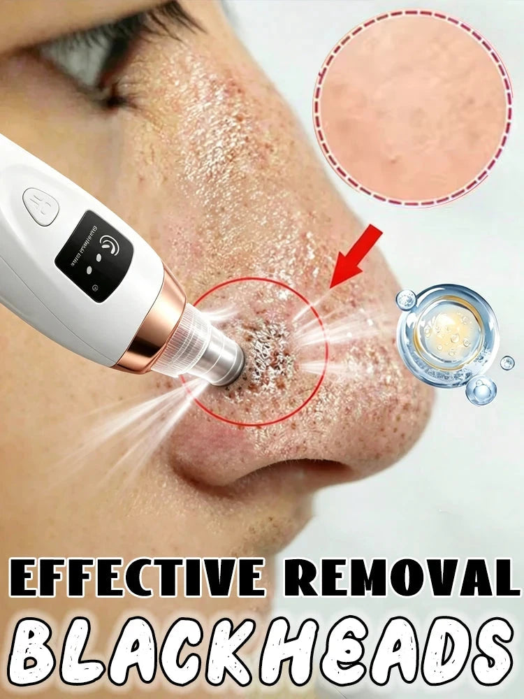Blackhead Remover Mask