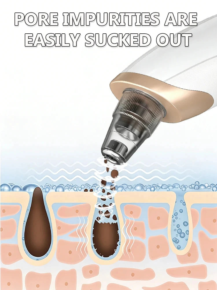Blackhead Remover Mask