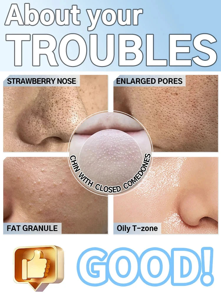 Blackhead Remover Mask