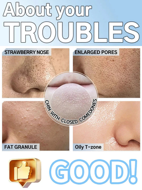 Blackhead Remover Mask