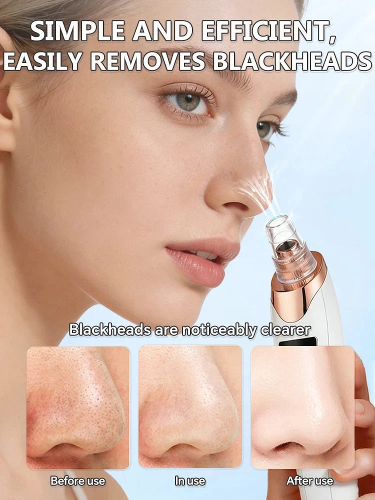 Blackhead Remover Mask